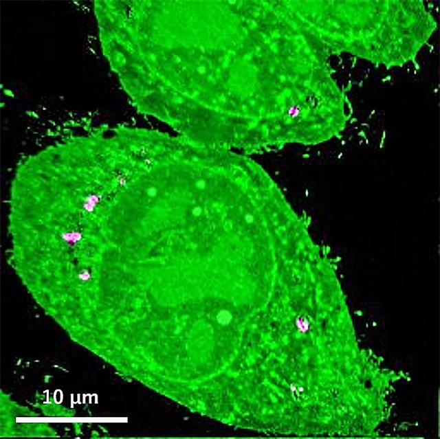 高空間分解能組成イメージング（ＮａｎｏＳＩＭＳ）で医薬品の細胞内分布観察像から薬効メカニズムを推測する