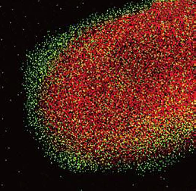 シリカコート材料の電子顕微鏡写真